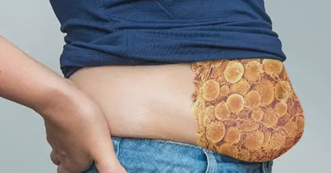 Stop Eating This One Thing—Or Keep Growing Stubborn Fat!