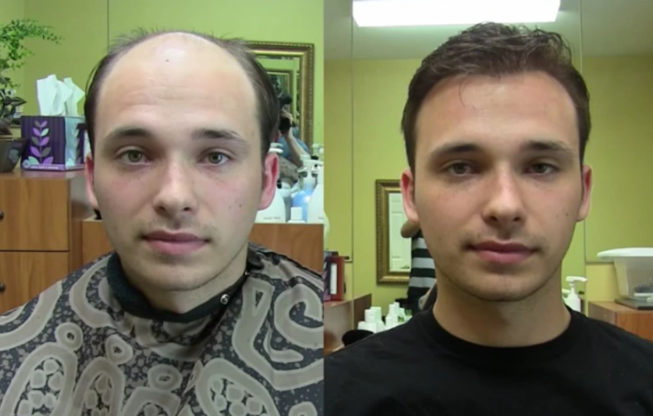 Top Doctor: Your Hair Will Grow Like Never Before (Stop Doing This)